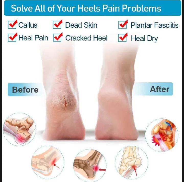 Silicone Gel Half Heel Pads (1 Pair) | Cushioned Heel Inserts for Foot Comfort & Shoe Fit