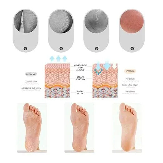Full Silicone Gel Foot Pads for Comfort | Reusable Cushion Insoles for Men & Women